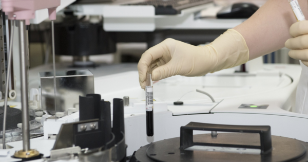 Clinical trials on weight loss peptides mean there may soon be more weight loss options available